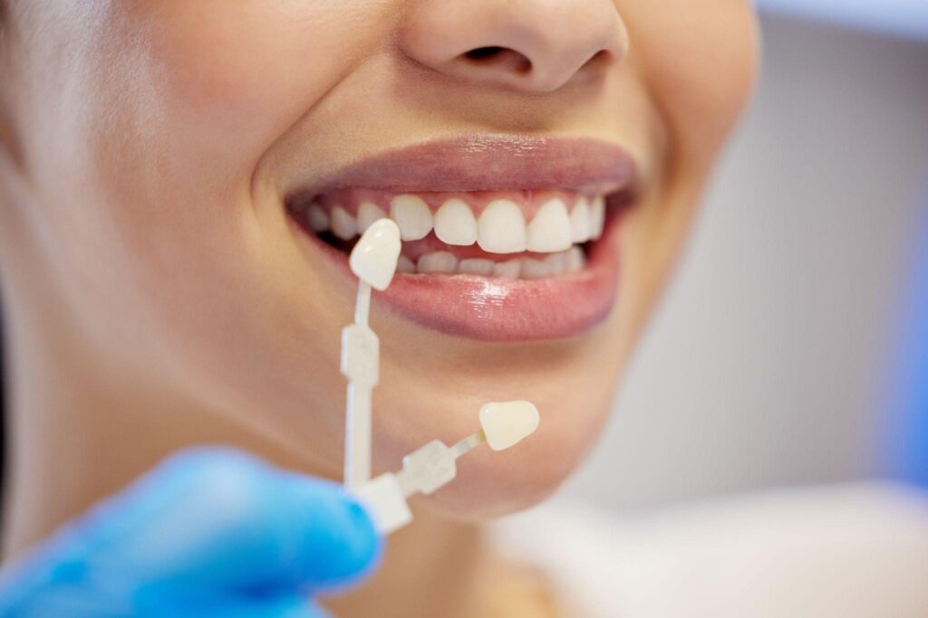 Close-up of woman smiling while choosing tooth shade for long-lasting teeth whitening results at a Bradenton dental office.