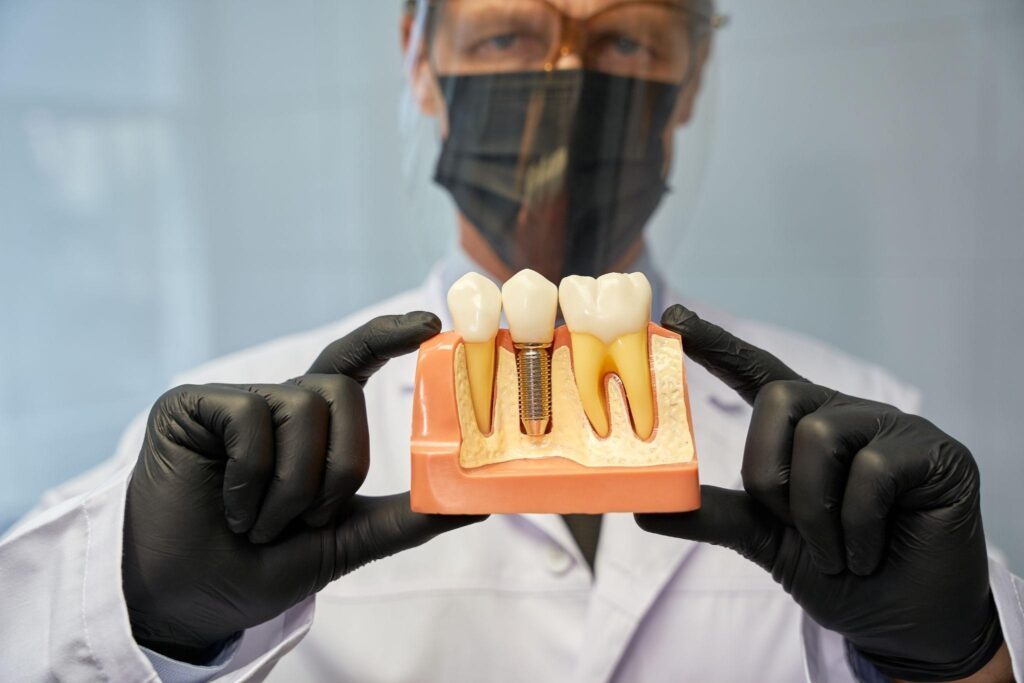 Dentist holding a model of dental implants showing how a tooth implant fits into the bone; does dental implant surgery hurt, and how implants replace missing teeth.