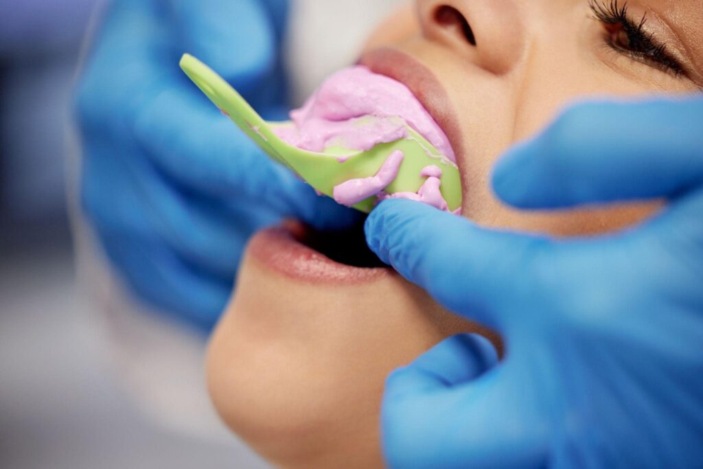 Patient undergoing a dental impression procedure for cosmetic dental treatment, showing the preparation step for custom restorations like veneers or crowns.