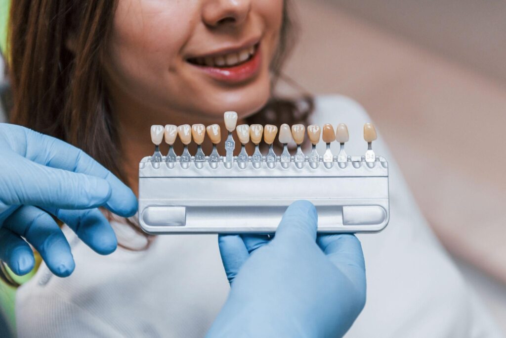 A dentist holds a dental shade guide in front of a patient’s smile to match the color for veneers or teeth whitening treatment, ensuring a natural and seamless result.